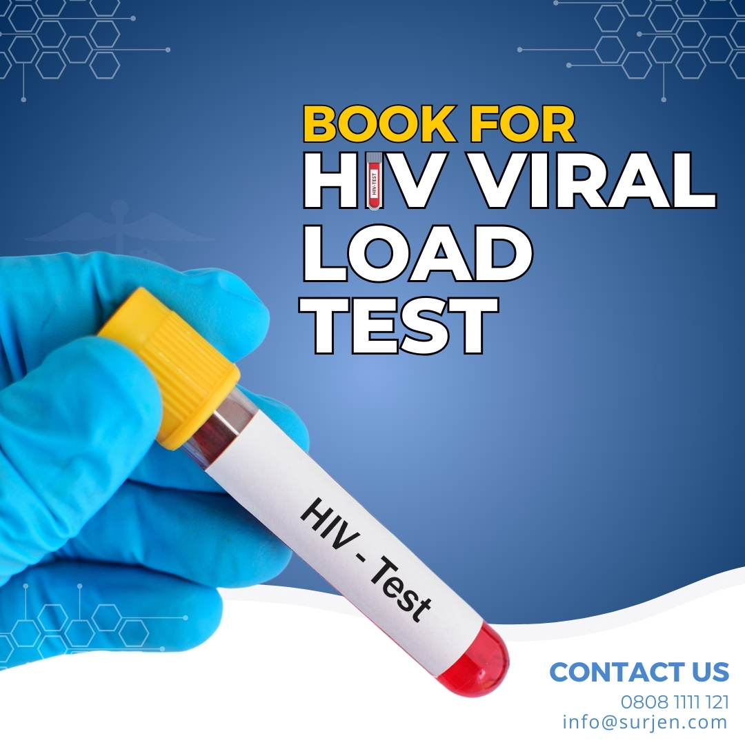 Your health is your responsibility. Surjen Healthcare encourages everyone to take the HIV Viral Load Test. Awareness is the first step towards a healthier, happier life. Get tested, stay informed! 🌍🩺
 #HIVPrevention #ViralLoadTesting #SurjenWellness #HealthMatters #HealthFirst