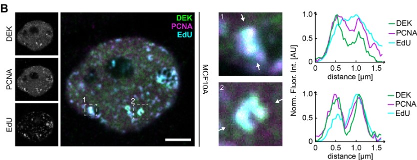 J_Cell_Sci's tweet photo. @MachPierzynska @IITalk, Christina Czada, Ferdinand Kappes, @ferrandoelisa, et al. discover that DEK oncoprotein forms SUMO-dependent nuclear bodies at active sites of constitutive heterochromatin replication.
Highlight: https://t.co/5jFNJ3iHb3
Article: https://t.co/d7kDudKsyG https://t.co/qslG19S9eV
