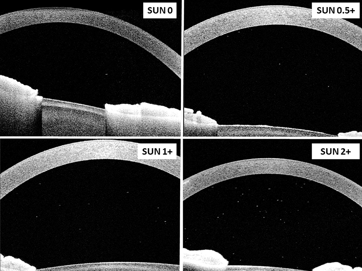 Dr Lola Solebo 💙👶🏾👁️👩🏾‍💻 tweet media