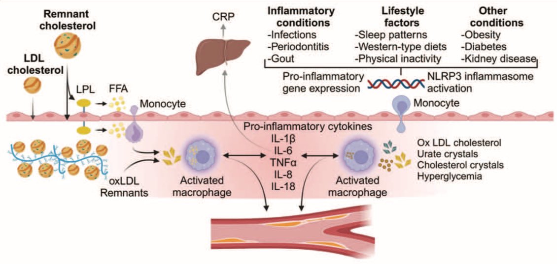 In our last review article, we discuss about how high remnant cholesterol combined with low-grade inflammation may confer a particular high risk for ASCVD. Attention on the dual threat from high remnant cholesterol and low-grade inflammation is necessary. <a href="/BNordestgaard/">Borge G Nordestgaard</a>