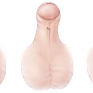 IJIR: Your Sexual Medicine Journal tweet media