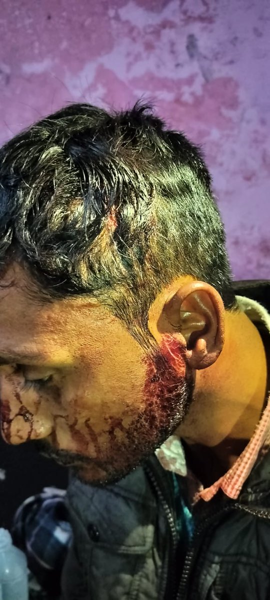 ShriNiwasSPN's tweet photo. @Uppolice महोदय ये मामला शाहजहांपुर के बंडा थाने के रायटांडा गाँव का है जिसमें गाँव के दबँगो ने मिलकर पूरे दलित के घर में घुस कर मारा है पीड़ित को झूठे मुकदमे में फसाने की धमकी दे रहें हैं जिससे पीड़ित परिवार काफी डरा  है अतः महोदय से प्रार्थना है की कार्यवाही करने की कृपा करें। https://t.co/5B8k3mQztq