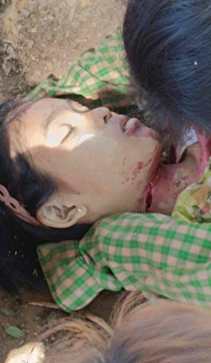 HURFOM's tweet photo. 1/4 A child was killed, and 2 women were injured from the artillery and small arms fired recklessly by the Junta after their trucks were attacked by a mine near Tha Pyay Nee village, Bilin Township, Mon State. https://t.co/7McocdfRG4