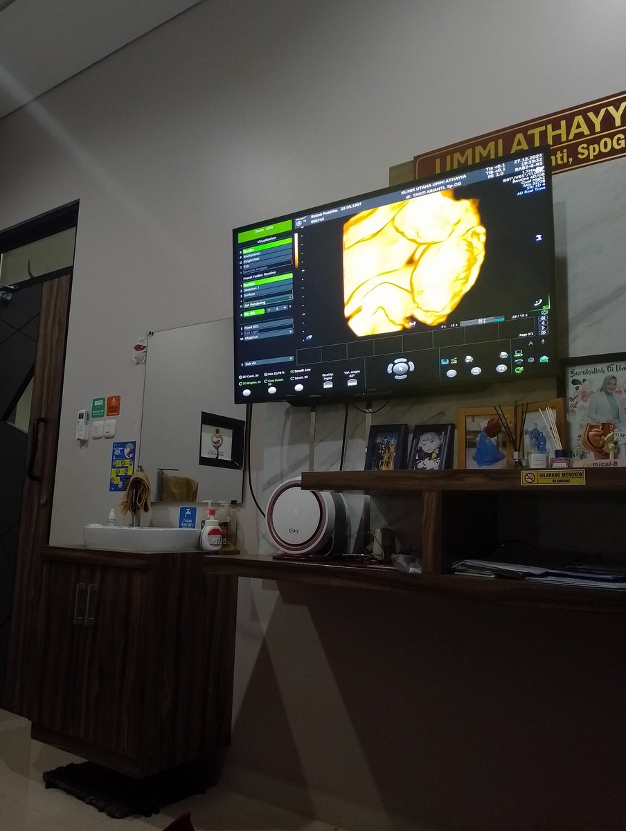 SiMenyul's tweet photo. Minggu ke 22, Alhamdulillah udah kelihatan gantengnya.. https://t.co/KgTwUU4Hb0