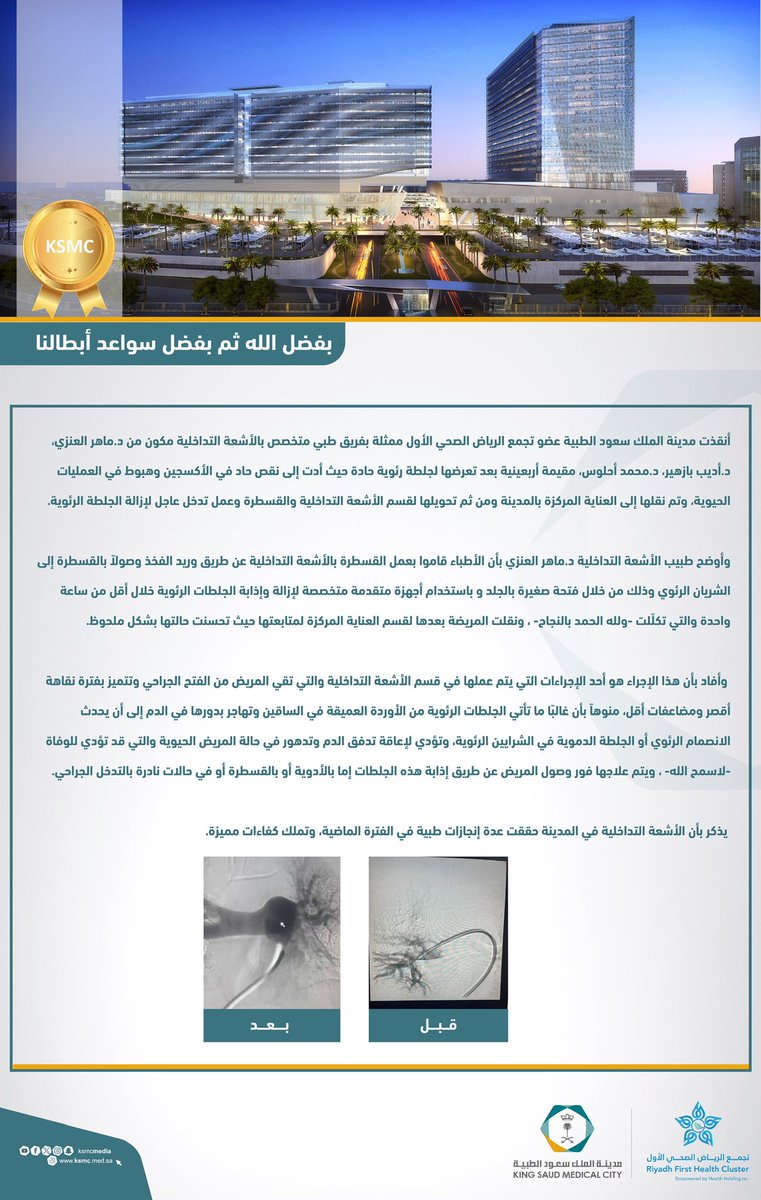 ksmcmedia's tweet image. ⭐️ | إنقاذ مقيمة أربعينية بـ #مدينة_الملك_سعود_الطبية بعد تعرضها لجلطة رئوية حادة أدت إلى نقص نقص حاد في الأكسجين.