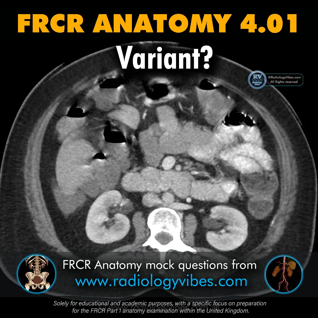 FRCR Anatomy 4.01: Name the normal anatomical variant. #radres #FOAMrad #FRCR #radiology #anatomy #MedTwitter #radtwitter #FRCRanatomy @Radiology_Vibes @anatomy4frcr @_the_SRT