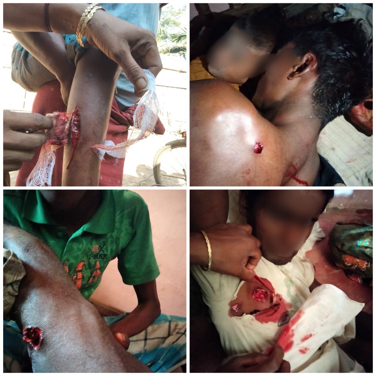 shafiur's tweet photo. TODAY Mrauk U: 

5 Rohingya wounded in Noa Para due to gunfire from #Myanmar junta military. Arakan Army entered into Rohingya villages with intention of targeting junta positions, prompting response from junta towards the villages. One killed in Sorpara today and several injured yesterday and today. #WhatsHappeningInMyanmar