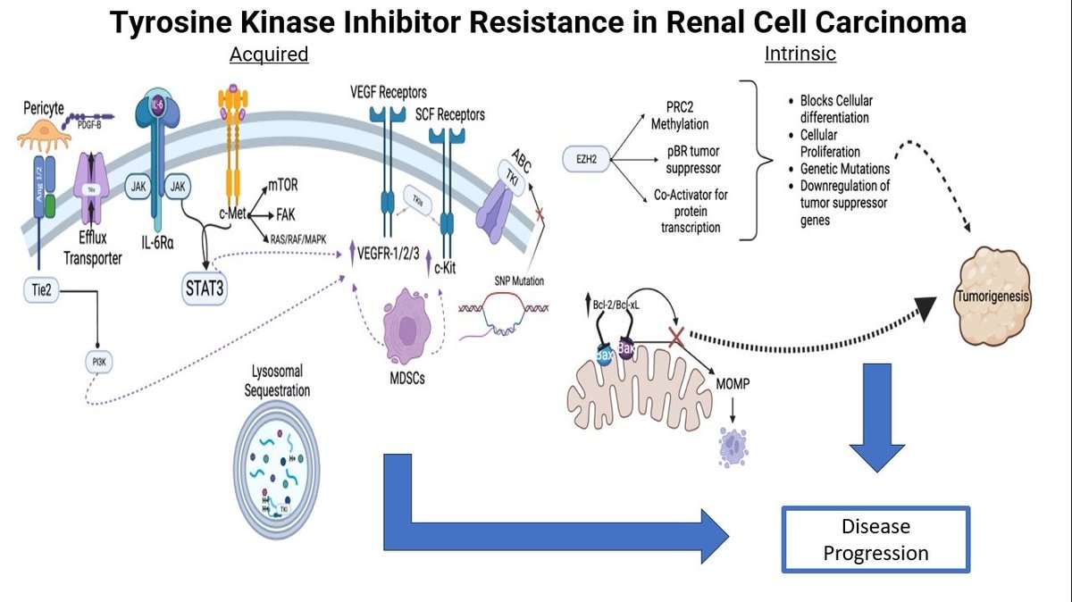 OAE_Publishing's tweet photo. Published in @cdrjournal,  this paper reviews mechanisms of tyrosine kinase inhibitor #resistance in #renalcellcarcinoma

Learn more:
https://t.co/rOjWuEYpCm

#sunitinib
#kidneycancer
#tumormicroenvironment
@Yash_Suri 
@koshkin85
@ADESAIONCMD https://t.co/VP6WXZqBLO