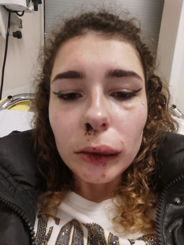Frontieresmedia's tweet photo. ⚡️[EXCLU LN] : un couple a été agressé à Toulouse par des dealers de type maghrébin hier soir. Le motif ? L’homme du couple a sermonné ses agresseurs après que ces derniers aient manqué de respect à sa compagne. La femme a 4 dents déchaussées, une dent cassée, le visage tuméfié. https://t.co/qlLF3fYwoP