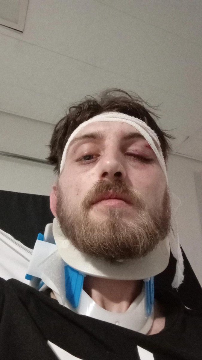 Frontieresmedia's tweet photo. ⚡️[EXCLU LN] : un couple a été agressé à Toulouse par des dealers de type maghrébin hier soir. Le motif ? L’homme du couple a sermonné ses agresseurs après que ces derniers aient manqué de respect à sa compagne. La femme a 4 dents déchaussées, une dent cassée, le visage tuméfié. https://t.co/qlLF3fYwoP