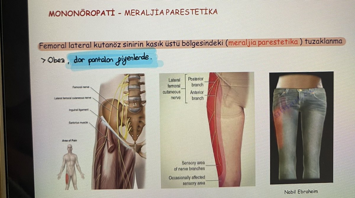 Dar pantolon pişmanlıktır