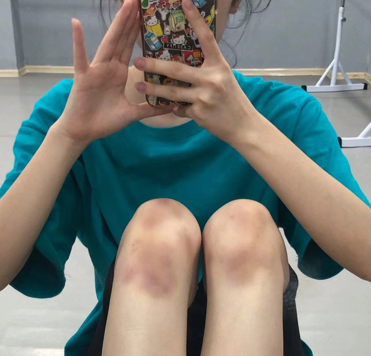 哪有什麼一步登天啊 路還很長 總不能一直哭
#記住自己的夢想  這點疼痛不算什麼  #舞蹈女孩 https://t.co/zMEvfyMagr