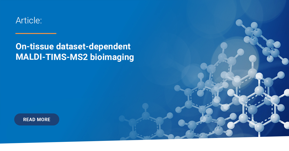 BrukerMassSpec's tweet photo. Having a need for high confident annotations directly from #MALDIImaging? Check out this new strategy for the dataset-dependent acquisition of mobility-resolved MS2 spectra in MALDI TIMS Imaging analysis: https://t.co/2cI0bWuiqt
#massspec #MALDI https://t.co/TLV8tIPPyA