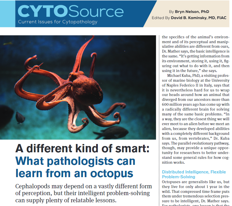 CancerCytopath's tweet photo. What pathologists can learn from an octopus: Cephalopods may depend on a vastly different form of perception, but their intelligent problem-solving can supply plenty of relatable lessons.
Revisit the award winning #CytoSource piece from @SeattleBryn: https://t.co/zwB4j1fx2I https://t.co/MRcR6BaCyz