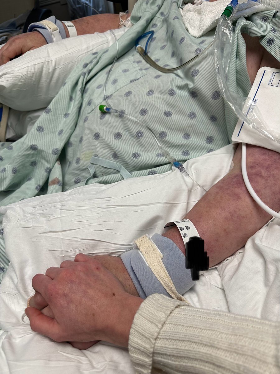 mitchdmoore's tweet photo. PRAYER REQUEST:

I spent Christmas in an ICU waiting room.

There is unimaginable power in prayer & faith that knows anything is possible with God.

So, i'm asking all my Christian brothers & sisters to pray for my father-in-law.

He is battling a rare blood disease called Vexas.

He's been in & out of hospitals & pumped full of steroids + numerous medications for over a year.

They've determined he requires a bone marrow transplant to have a chance of survival for which testing has been scheduled for early January.

His blood disease & steroid medications make him highly susceptible to infection & illness.

His immune system is highly compromised making additional diseases extremely difficult to fight off.

& just when we thought he would make it to his testing date to start the transplant process...

He came down with RSV and was admitted to the ICU, then put on a ventilator.

Doctors & nurses are doing everything they can to help, but I fully recognized God is the only one who can heal him.

So, I ask that you pray diligently & with crazy faith that he is miraculously healed.

Many people believe we have no say over God's will & it will be done no matter what we do.

But I am crazy enough to have faith that God will answer our prayers.

My father in law is a war hero, pastor, & a man deeply in love with Jesus that professes his faith to anyone who will listen.

He's an encourager & a light to everyone who knows him.

God can still do incredible work through him for the Kingdom.

Please join me & have faith for the impossible.

Pray over him with absolute conviction.

Thank you. God will receive every ounce of the glory.

Please share this. We need every prayer we can get.

With love - Mitch. ❤️