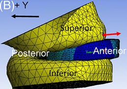 BonassarLab's tweet photo. Congratulations to Maho Koga on her article in @JorSpine using finite element modeling to design resorbable implants to support tissue-engineered intervertebral discs (https://t.co/ejYaInX2Wv). @CornellBME @CornellMAE @WCMCBrainSpine #TeamIVD https://t.co/YoEmfY8gAN