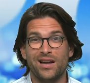 DrSandroDemaio's tweet photo. @theprojecttv @SandroDemaio The secret to simulating worry lines on a Botox laced forehead is to work those eyebrows hard! 

I found I had to squint to stretch the skin flat again.  

Get some fruit and veg into you peope! 🍑🍆 https://t.co/WFrfthwF2e