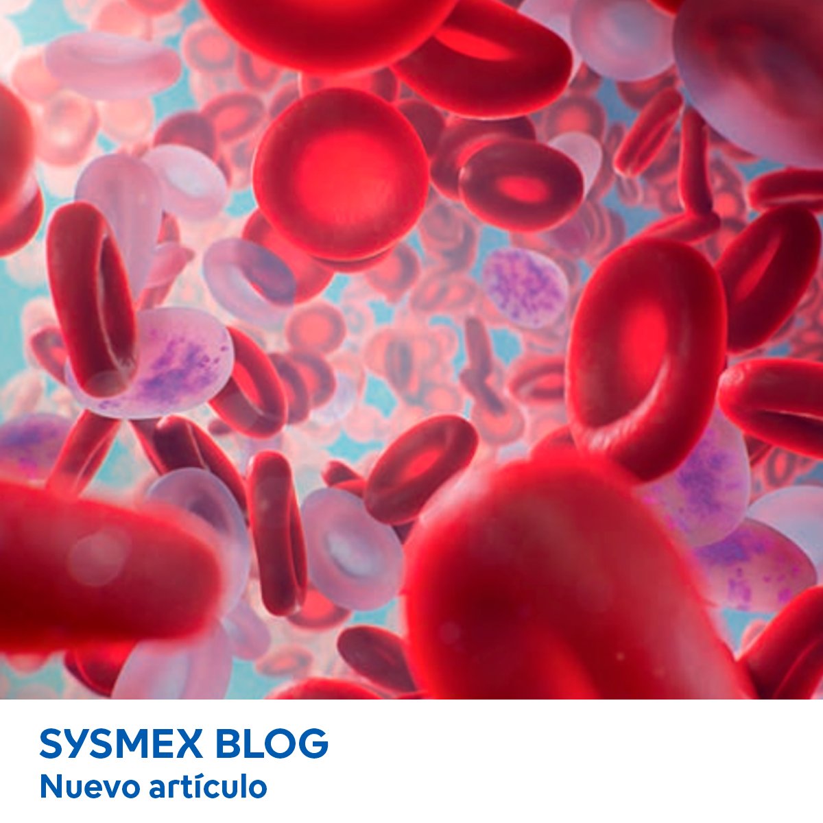 Sysmex_Es's tweet photo. 🩸 La #anemia afecta a un tercio de la población mundial, especialmente a mujeres y niños.
🔎 Descubre cuáles son sus síntomas, así como los métodos más efectivos para su detección.
Accede al artículo del #SysmexBlog 👇
https://t.co/xDmXypyHyQ https://t.co/uzBgLE9H4K