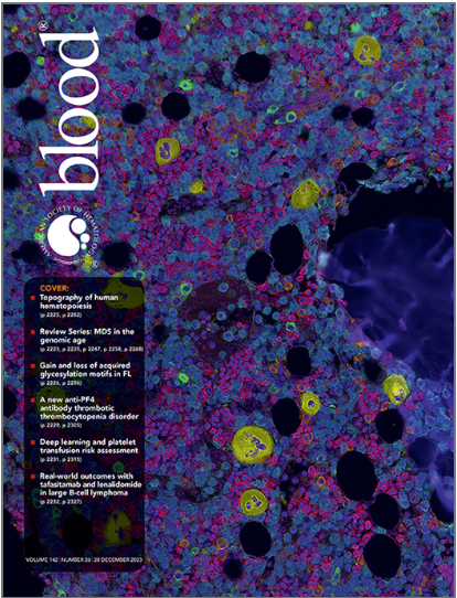 SanjayPatelMD's tweet image. Elated to end 2023 with our work featured on the cover of the latest issue of @BloodJournal! Thanks to the editors for selecting our study, and for the insightful commentary by @oscarbruck! #hematopoiesis #stemcells #bonemarrow #ArtificialIntelligence
ashpublications.org/blood/issue/14…