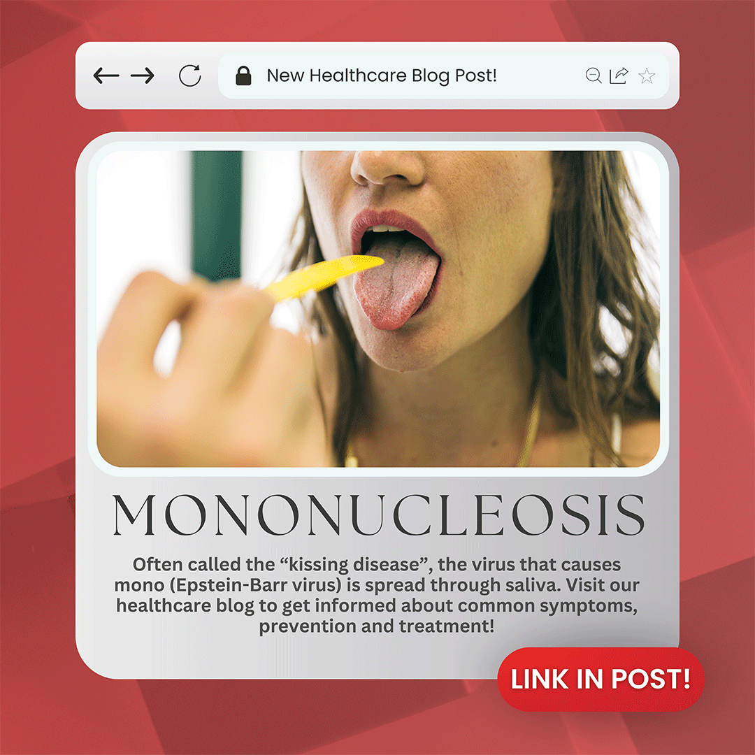 Mononucleosis, or mono, is a viral infection that causes fever, sore throat, and swollen lymph glands, most often in the neck.

Visit our healthcare blog: bit.ly/3H3P4fy to learn more about mononucleosis, its symptoms, and tips for treatment, prevention, and care!