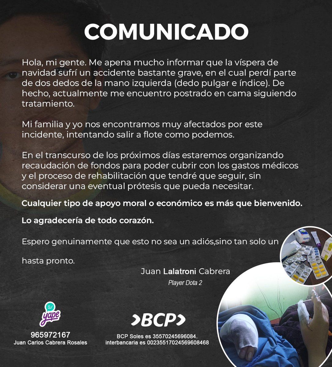 justopancho's tweet image. El jugador de Dota 2 Lalatroni, que iba a jugar para LAVA durante el 2024, sufrió un accidente que le ha perjudicado dos dedos de la mano izquierda.

Actualmente se encuentra recaudando fondos para cubrir los gastos médicos y la rehabilitación por la que deberá pasar.

Si desean