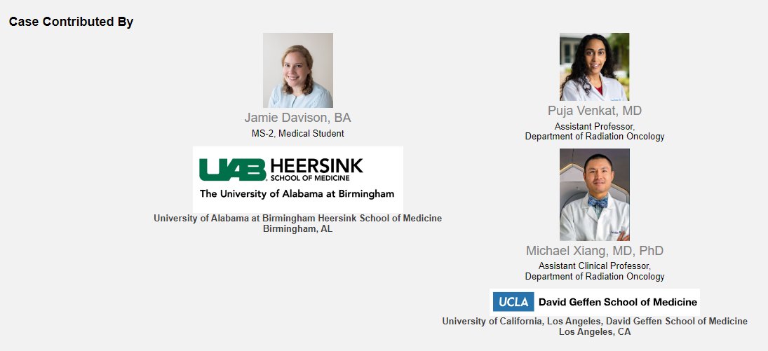 Check out today's @RadiologyACR #CaseInPoint--a great tutorial for #radonc in picking up abnormalities on #breastcancer CT simulations--and a lesson in clinical medicine Many thanks to Jamie Davison BA, MS2 at @UABradonc, Puja Venkat MD and Michael Xiang MD, PhD at #UCLAradonc…