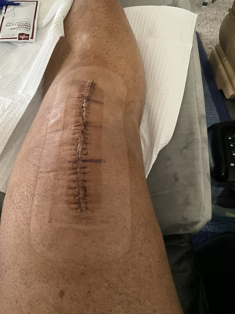 Butch Baccala tweet media