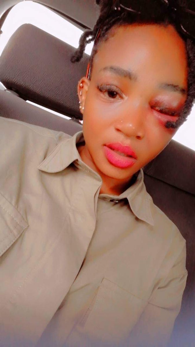 AdvoBarryRoux's tweet photo. How can you do this to someone you claim to love? Some Men are Dogs. No matter how a woman cheats never raise your hands on her just walk away in peace! https://t.co/QqWhfT8HSe