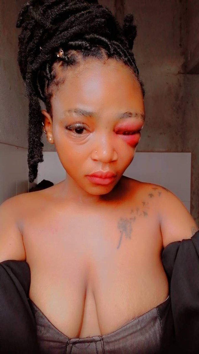 AdvoBarryRoux's tweet photo. How can you do this to someone you claim to love? Some Men are Dogs. No matter how a woman cheats never raise your hands on her just walk away in peace! https://t.co/QqWhfT8HSe