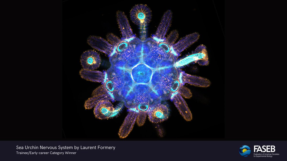 FASEBorg's tweet image. Did you enjoy this year's FASEB BioArt Awards? 🔬🖼️ The stunning visuals showcase scientists’ research and communicate an essential aspect of 21st-century biological and biomedical research. Each awardee received $500. bit.ly/3vg9nUJ #bioart #sciart