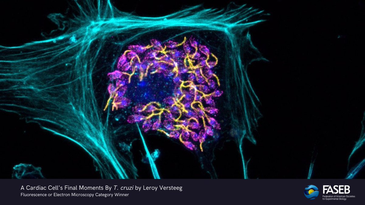 FASEBorg's tweet image. Did you enjoy this year's FASEB BioArt Awards? 🔬🖼️ The stunning visuals showcase scientists’ research and communicate an essential aspect of 21st-century biological and biomedical research. Each awardee received $500. bit.ly/3vg9nUJ #bioart #sciart