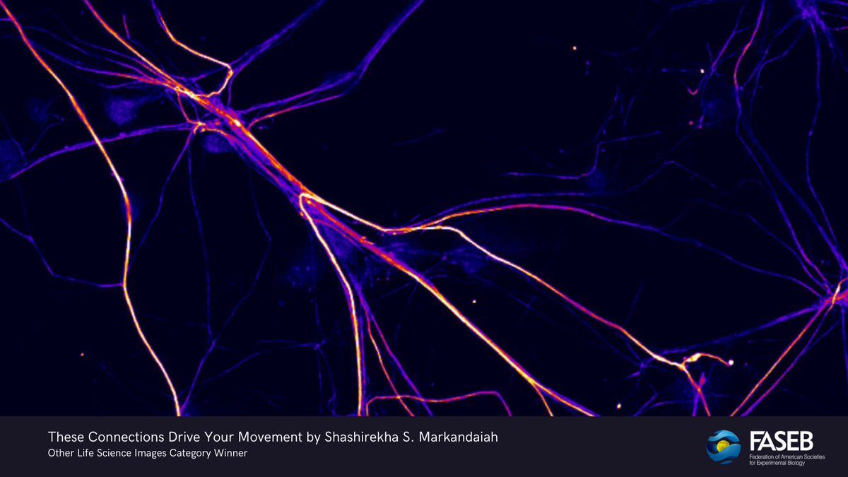 FASEBorg's tweet image. Did you enjoy this year's FASEB BioArt Awards? 🔬🖼️ The stunning visuals showcase scientists’ research and communicate an essential aspect of 21st-century biological and biomedical research. Each awardee received $500. bit.ly/3vg9nUJ #bioart #sciart