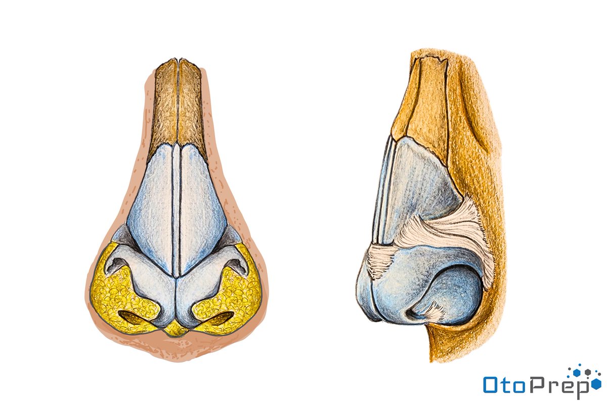 Dive into Rhinoplasty anatomy with #OtoPrep! 🧐 Can you identify where nasal bones meet cartilages? Spot key structures from quadrilateral cartilage to the scroll area. Test & share your answers! 📚 #NoseAnatomy #ENTeducation #MedStudents #MedEd #Rhinoplasty #Otolaryngology