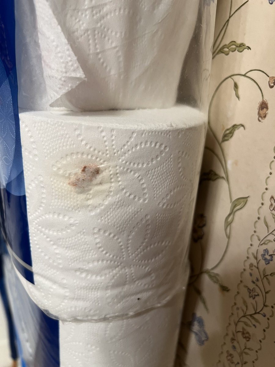 WinstonWonder's tweet photo. @Costco not sure what happened here but something got on the toilet paper before packaging it.🤢 https://t.co/AmgW4T3pKS