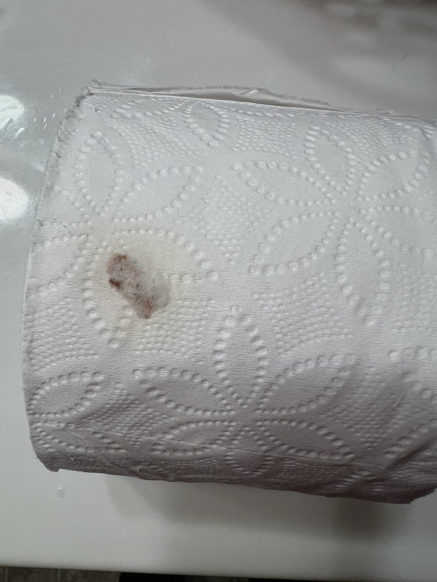 WinstonWonder's tweet photo. @Costco not sure what happened here but something got on the toilet paper before packaging it.🤢 https://t.co/AmgW4T3pKS