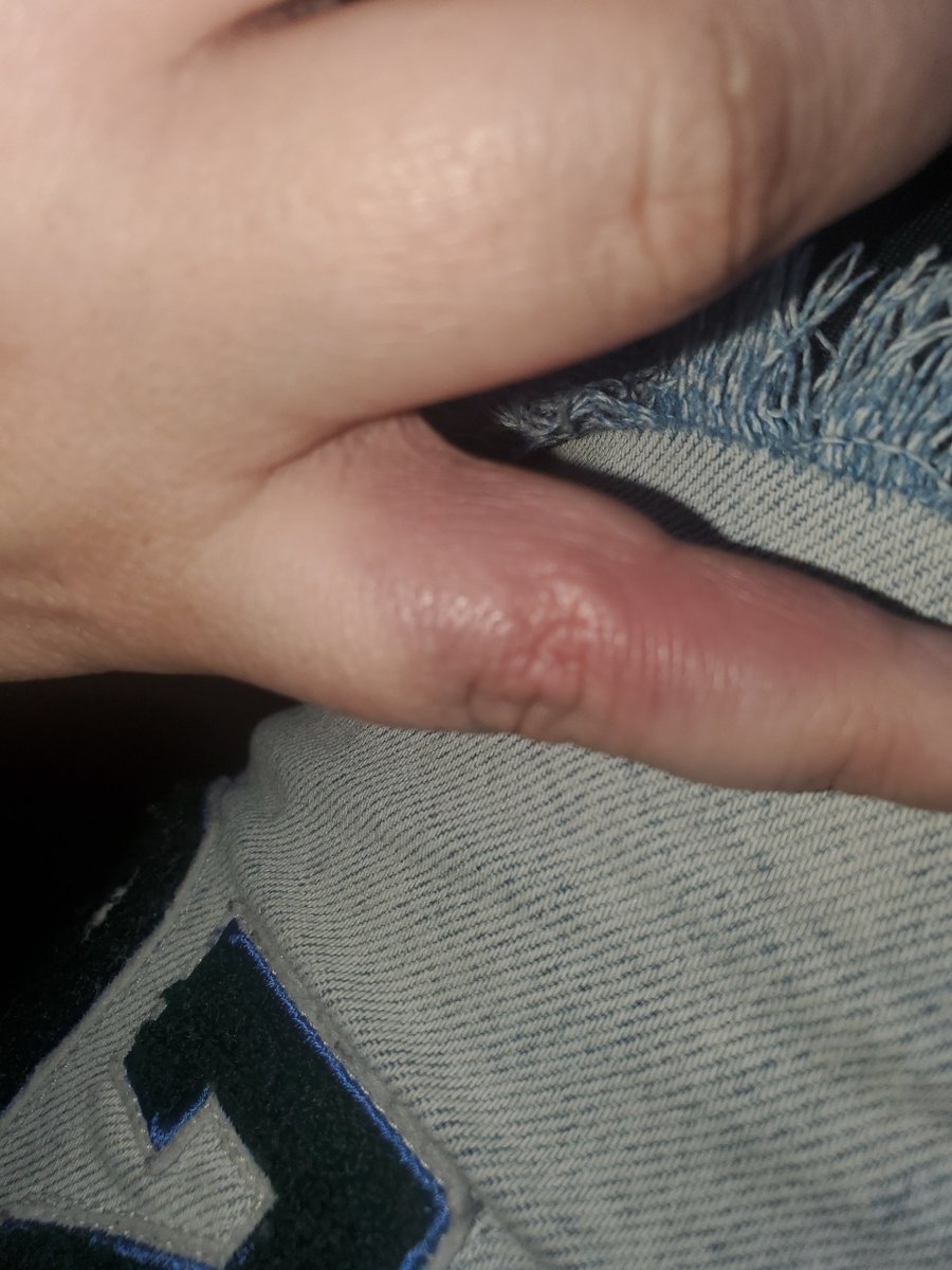 starlighteye420's tweet photo. Hey @BigLots I'd appreciate it if you'd have your staff not put broke items on shelves. Went to open a container I wanted to buy and the spring was broken pretty sure it broke my finger 😭 https://t.co/s1vj1feVZr