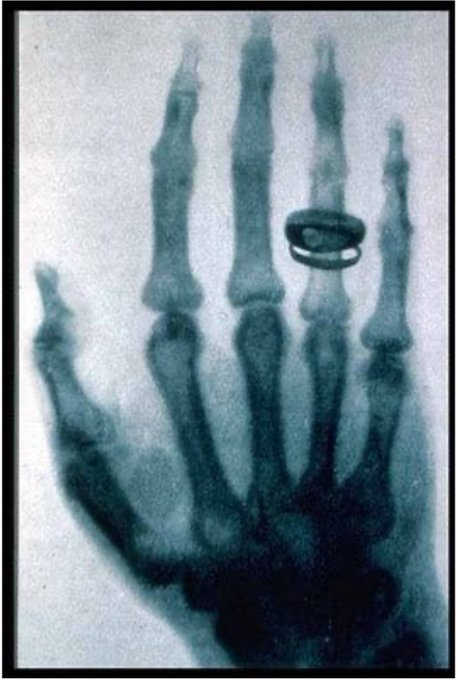 In 1895&nbsp;Wilhelm Conrad Rontgen announces that he has taken an x-ray of his wife&rsquo;s hand in a paper, "Ein<a href="/tag/solareclipse"class="tags"><span>#solareclipse</span></a><a href="/tag/somewhereovertherainbow"class="tags"><span>#somewhereovertherainbow</span></a><a href="/tag/israe"class="tags"><span>#israe</span></a>