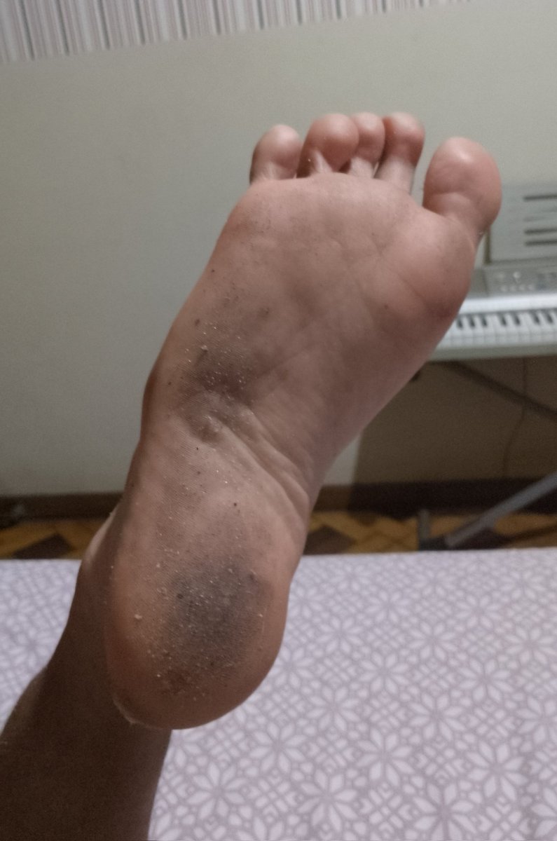 MisterLAlpha's tweet photo. Uh-oh. Funky heel needs affection. Work your toungue gently, or else you will get a slap on your head and spit on your face. Now send me a picture of your girlfriend.

paypig finsub cashmaster alpha beta goon daddy blackmail humiliation finsub drain dirty feet worship soles toes https://t.co/2dSPuaMFdX