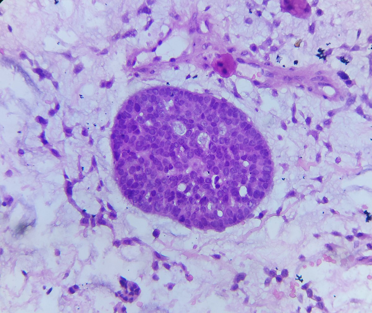 🫵🏻You move to a new 🏙️city and meet an old friend 🙋🏻 : 'I did not expect to see you here!'

New city : Hypolarynx
Name of that friend : ___________?

#pathX #pathology #pathTwitter #ENTPath