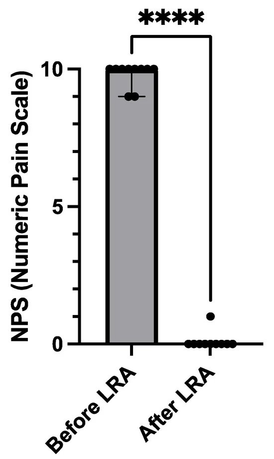 Tendremos que pensar en la #anestesia locorregional (LRA) y llamar a nuestros colegas anestesiólogos para tratar el #dolor en #drepanocitosis si no podemos controlarlo con #morfina. Efecto inmediato y dura 12-16 h. 
<a href="/sedar_es/">SEDAR</a> mdpi.com/1648-9144/59/1…