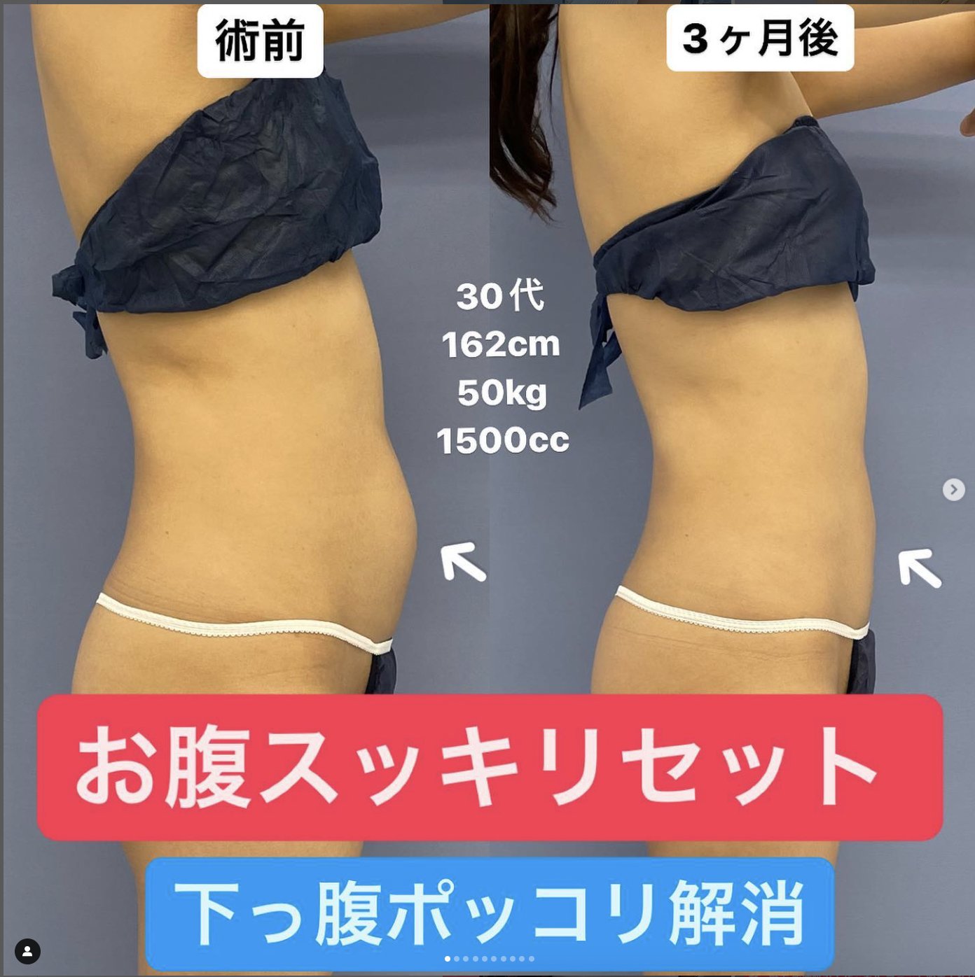 お腹減った Amazon.co.jp: S帯(エスおび) ブラック LL～3L(ウエスト77～93cm