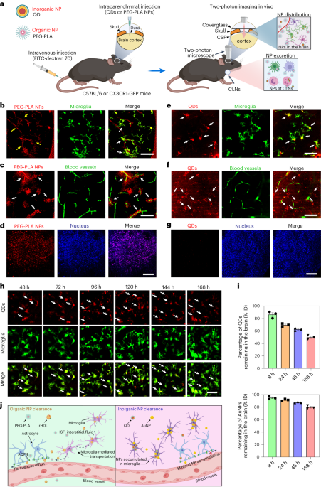 NatureNano's tweet photo. New content online: Intracerebral fate of organic and inorganic nanoparticles is dependent on microglial extracellular vesicle function https://t.co/w6azLXPfjK https://t.co/GKO7O9JDZm