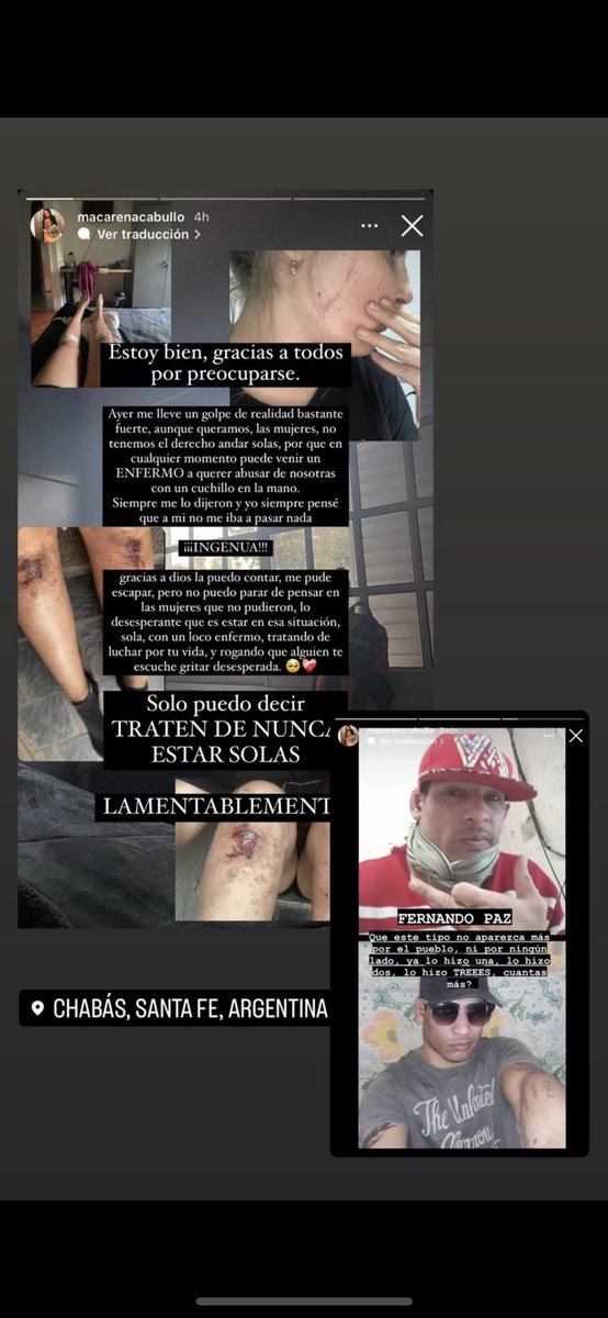 Escrache social a esta lacra que seguro entra 1 semana y lo largan enseguida , chorros negros , no puede ser que pase esto en un pueblo , que no se puede andar tranquila porque te roban , te quieren acuchillar ,negros que no sirven para nada solo para hacerte pasar un mal momento
