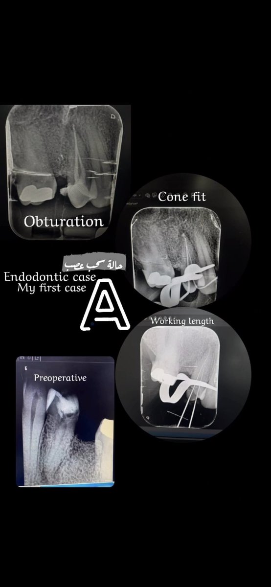 My first case ☺️