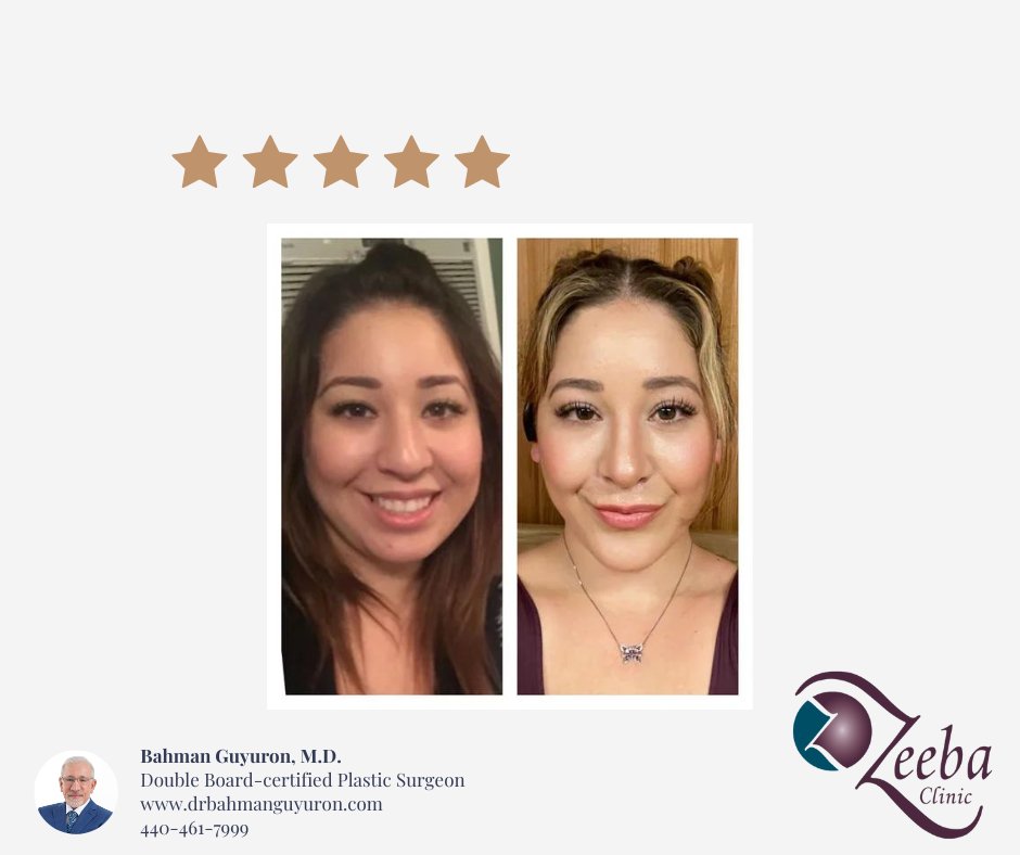 Bahman Guyuron, MD tweet media