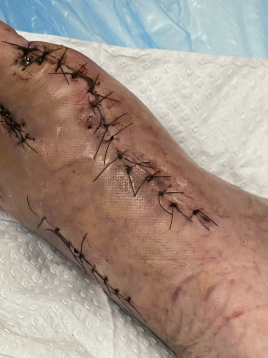 Diane Wake 💙 tweet media