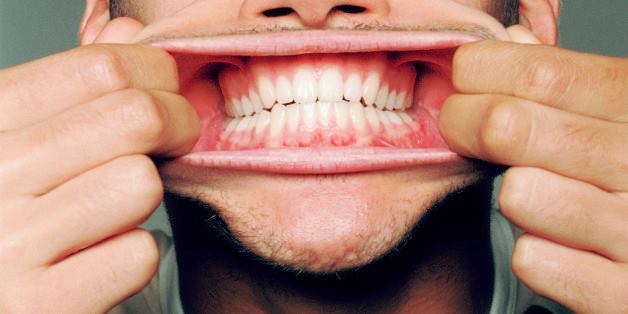 Si la enfermedad periodontal es diagnosticada en la etapa temprana de gingivitis, puede ser tratada con una limpieza profesional completa. Comienza el año con tus encías rosadas y saludables!