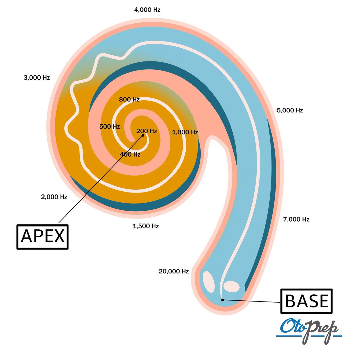 OtoPrep's tweet photo. ๐ง Got a minute? Test your #ENTknowledge! A patient needs a cochlear implant. How will cochlear tonotopy affect electrode placement? #OtoPrep #MedEd #Audiology #Otolaryngology #HearingLoss #Anatomy #ENTdoctor #ENTeducation #MedTwitter #ENTExams # https://t.co/ey1a4XBlPo