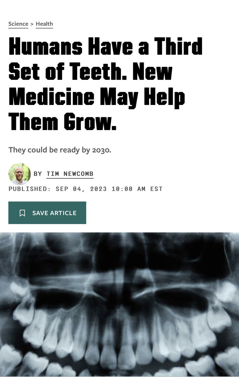 We really got Teeth 3 before GTA 6