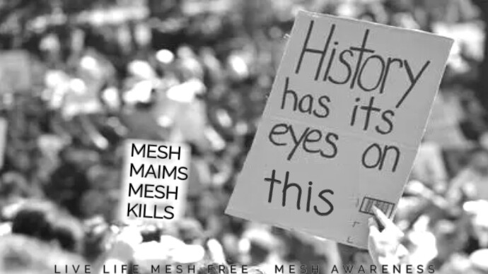 JanUrban12's tweet image. Inappropriate Cures created for Wealth has Irreversibly Harmed 100,000's Worldwide. Polypropylene Surgical Mesh #Biocompatible? Think Again? No matter how Mesh is Biochemically Engineered, it will always be a piece of Toxic #Plastic Know the Risks #MeshAwareness